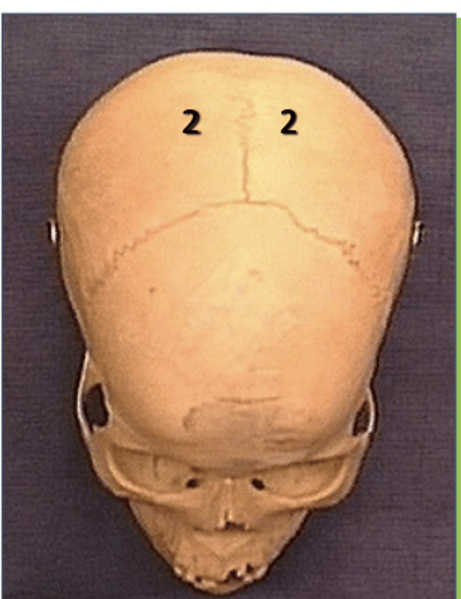 <p>posterior the frontal lobe</p>