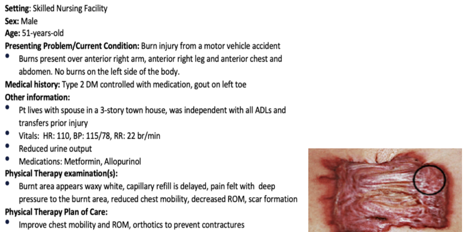<p>During follow-up a few months later, the patient is concerned about a scar on his right arm, as shown below. What is the type of scar seen in this patient?</p><ol><li><p>normal scar</p></li><li><p>hypertrophic scar</p></li><li><p>atrophic scar</p></li><li><p>keloid scar</p></li></ol><p></p>