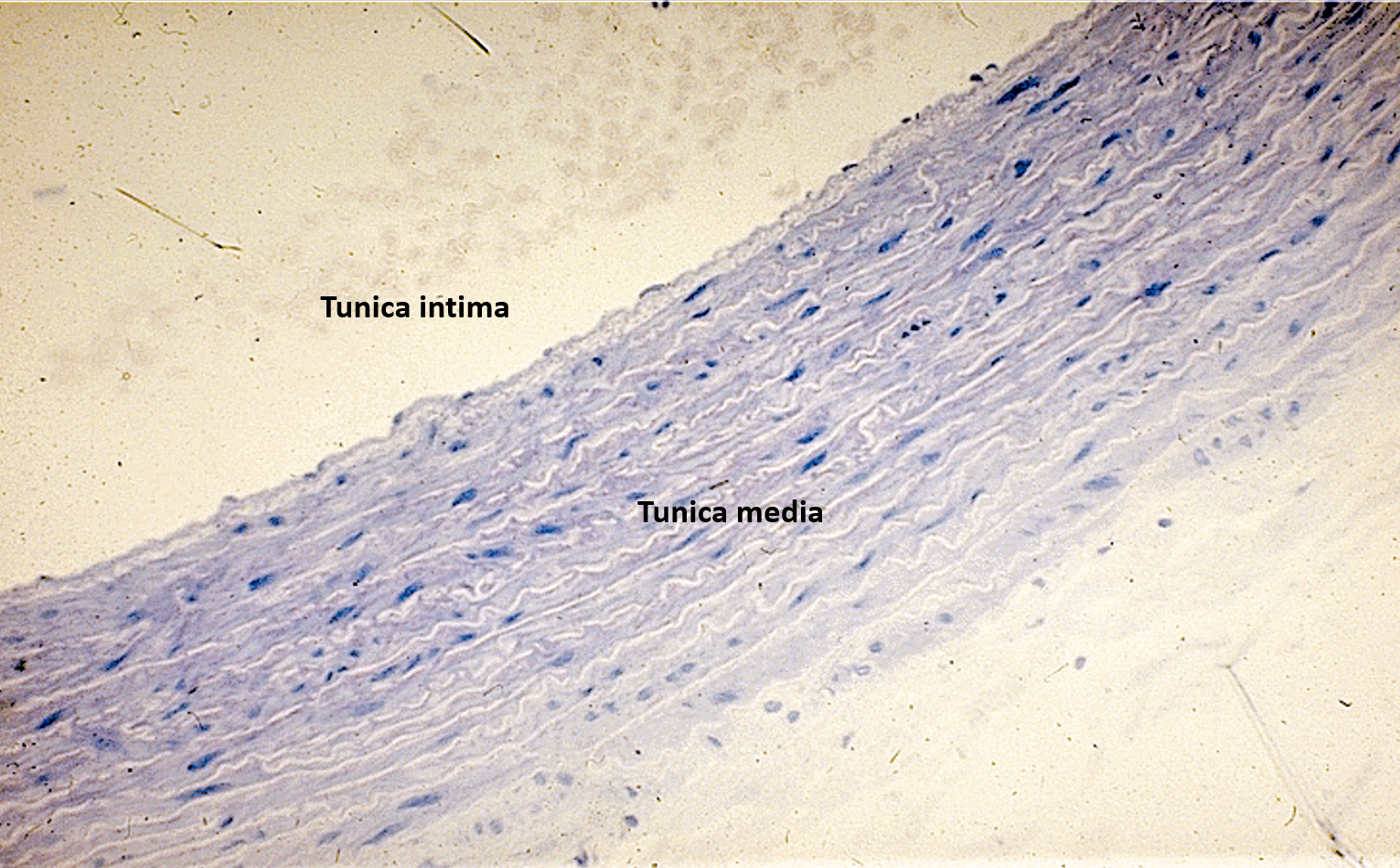 <p>Aorta</p><p>Wavy lines = elastic fibers</p>