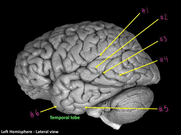 <p>What sulcus is #1</p>