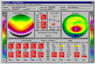 <ul><li><p>Elevated in all types of corneal surface irregularity</p><ul><li><p>Normal + pathological</p></li></ul></li><li><p>Examples incl:</p><ul><li><p>Scars</p></li><li><p>Astigmatism</p></li><li><p>CL–induced deformities</p></li><li><p>Keratoconus</p></li></ul></li><li><p>Red = pathological</p></li><li><p>Yellow = out of normal range</p></li></ul><p></p>