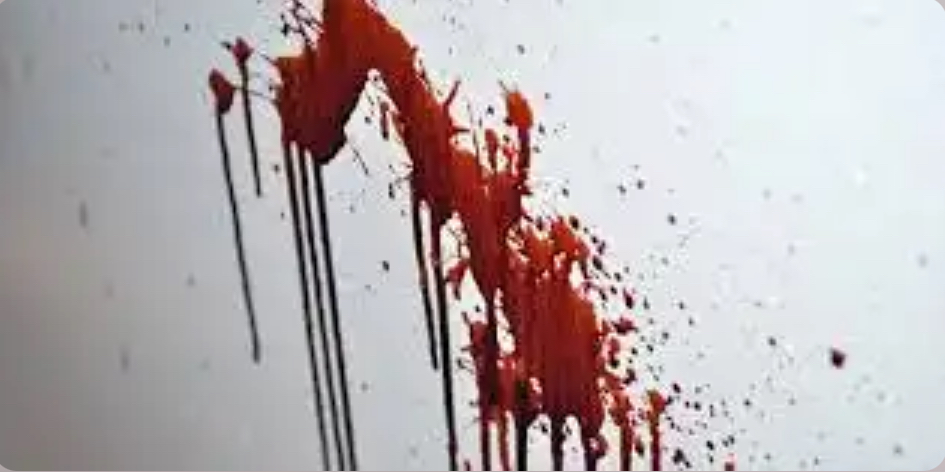 <p>What caused this blood stain pattern</p>