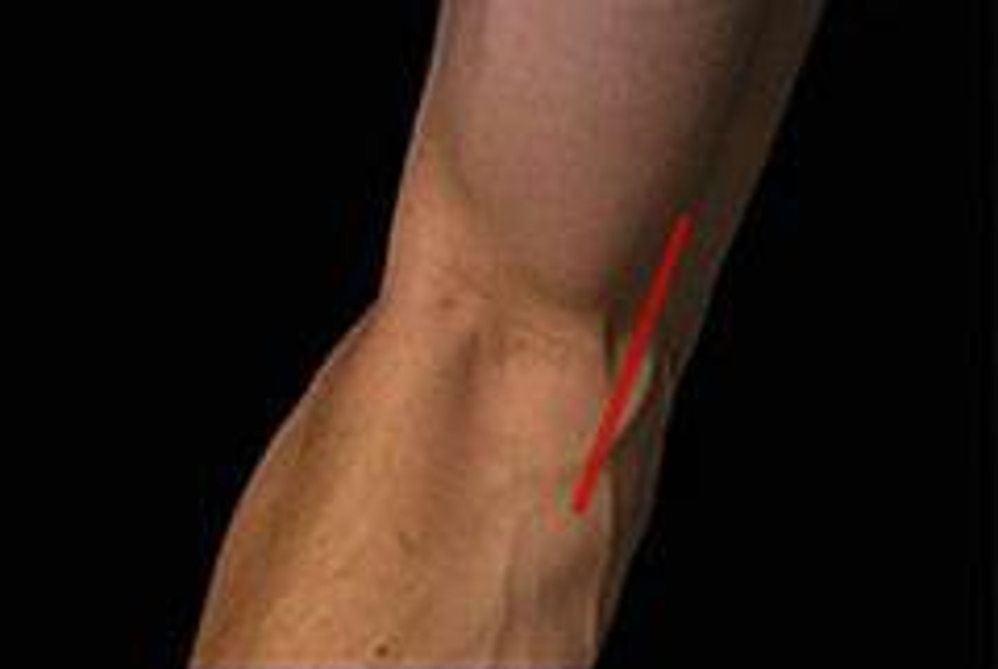 <p>inside of the elbow at the antecubital space.</p>