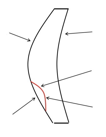<p>Bifocal surface notations (eg F1)</p>
