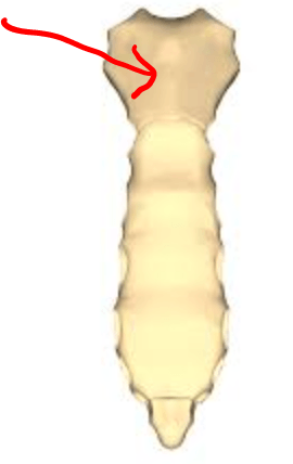 <p>What is the arrow pointing to?</p>