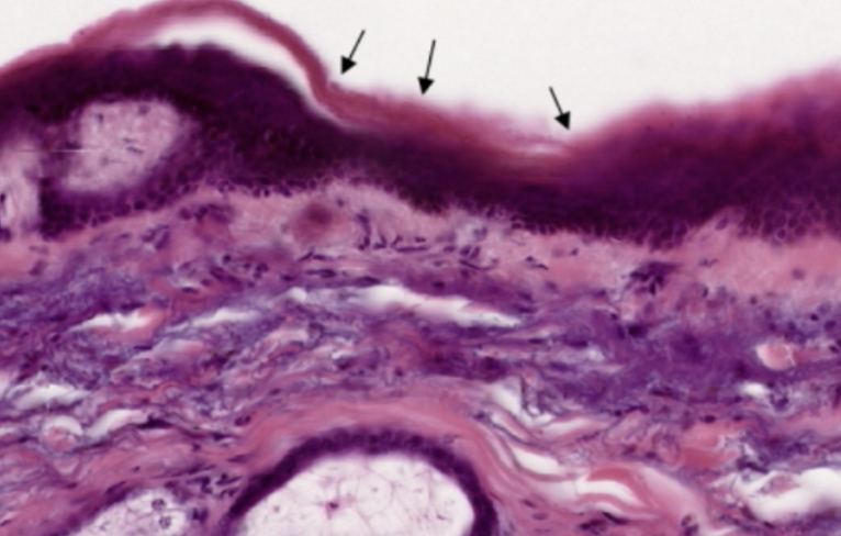 <p>What organ specimen is shown in this slide?</p>