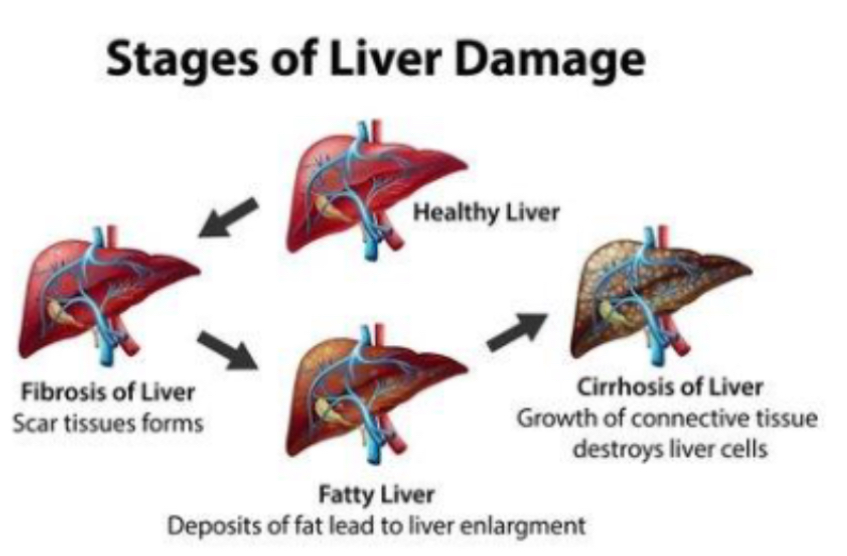 <p> PHOTO <span>What does the liver regeneration and damage diagram show?</span></p>