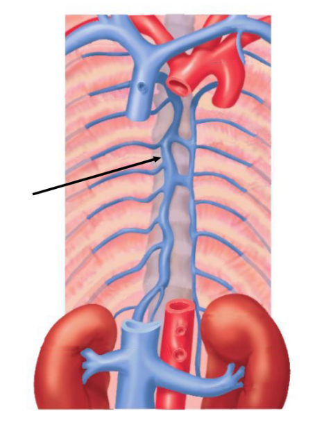 <p><span>The vein of the thoracic cavity indicated in this figure is the____vein</span></p>