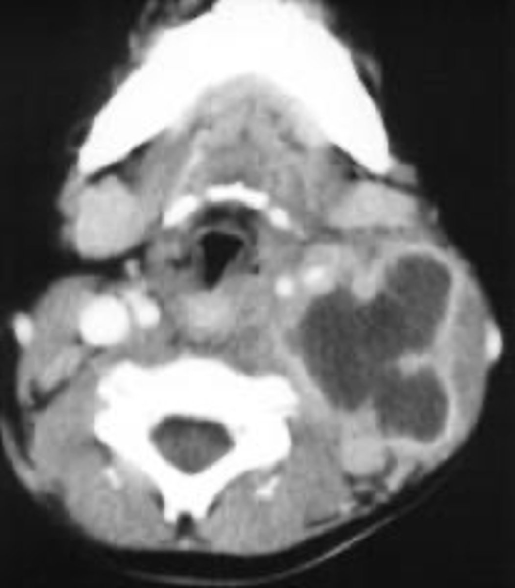 <p>ID the type of Imaging modality:</p><p>- Pano</p><p>- CT</p><p>- CBCT</p><p>- MRI</p><p>- Technetium 99 bone scans</p><p>- PET</p>