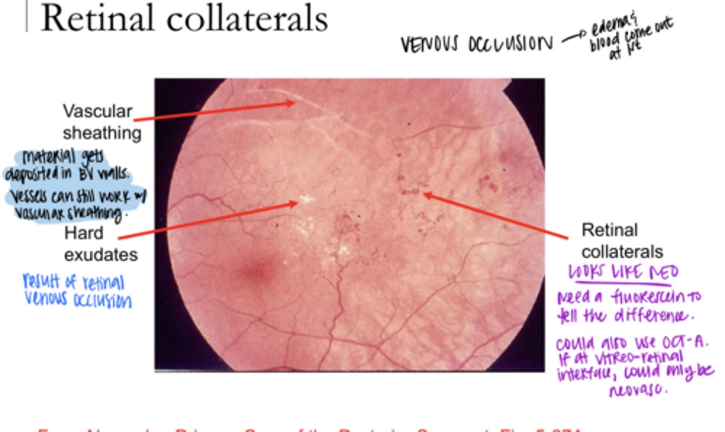 <p>Are retinal collaterals effective in establishing new pathways of blood flow in the retina?</p>
