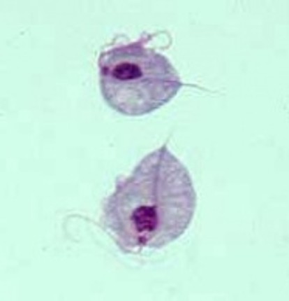 <p><strong>infex of Tritrichomonas foetus</strong></p>