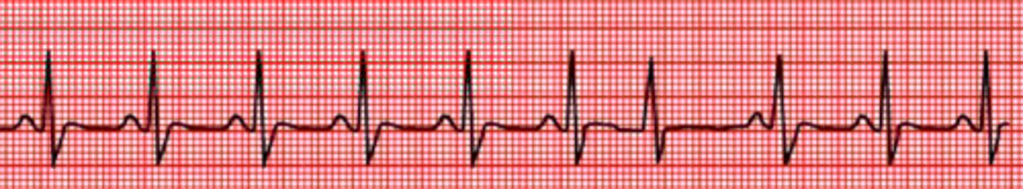 <p>Name the rhythm</p>