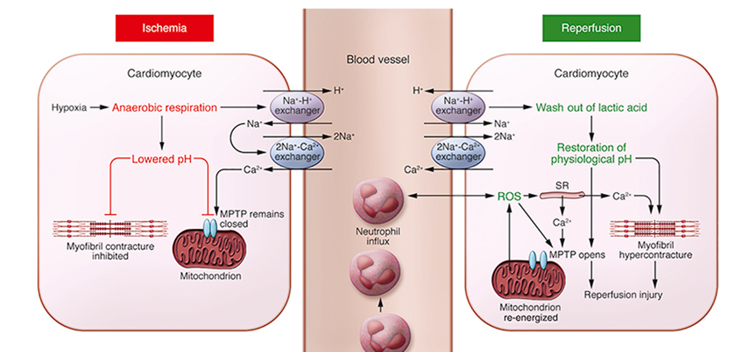 <p><span>Rapid reperfusion can lead to reperfusion injury. After not being able to provide for some time due to lack of nutrition, the cell of this organ will be kind of rusty leading them to create rusty molecules (ex. free radical) when reperfuse. When replenish too fast, it will lead this accumulation of rusty molecules in the body leading to oxidative stress that lead to multiple pathological effect (ex. mutation, cell membranes damage, etc.)</span></p><p><br></p>