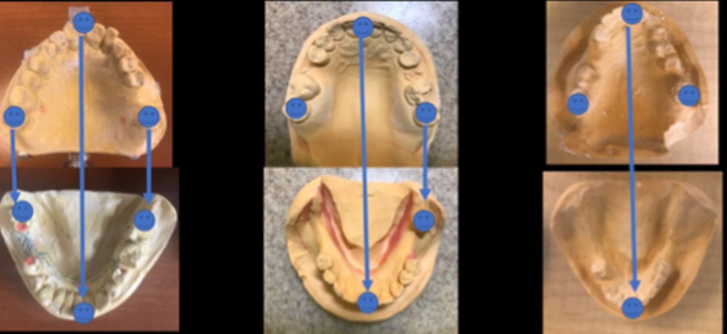 <p>tripod of opposing contacts</p>