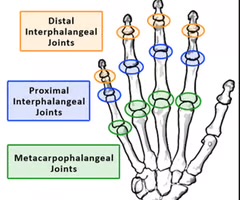 <p><span>distal interphalangeal joint. the joint between the middle and distal phalange of a given finger or toe.</span></p>