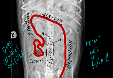 <p>Normal Abdomen Colon and Cecum on Radiographs </p>