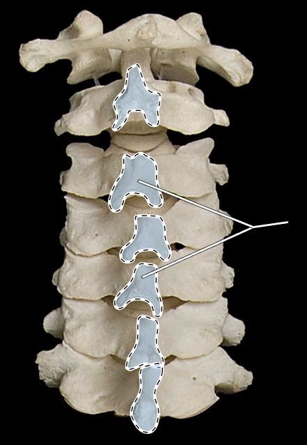<p>What part of the vertebra is highlighted?</p><p>What region of the vertebral column is this?</p><p>(Posterior view).</p>