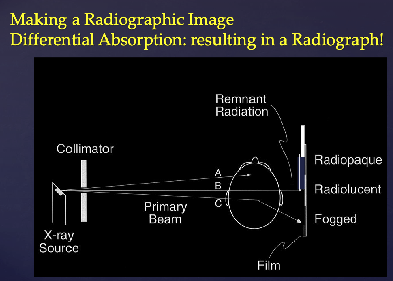 <p>30%</p><p>Causes fogging (darkening) of the film/receptor while carrying no useful information due to altered path</p>