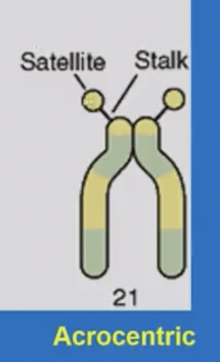 <p>-only in chromosomes 13-15, 21,22</p><p>-small dots at the tip of the P arm</p><p>-contains coding regions for rRNA</p><p>-assists in building nucleioli</p><p>-p arms are above centromere (short)</p><p>-q arms below centromere (longer)</p>