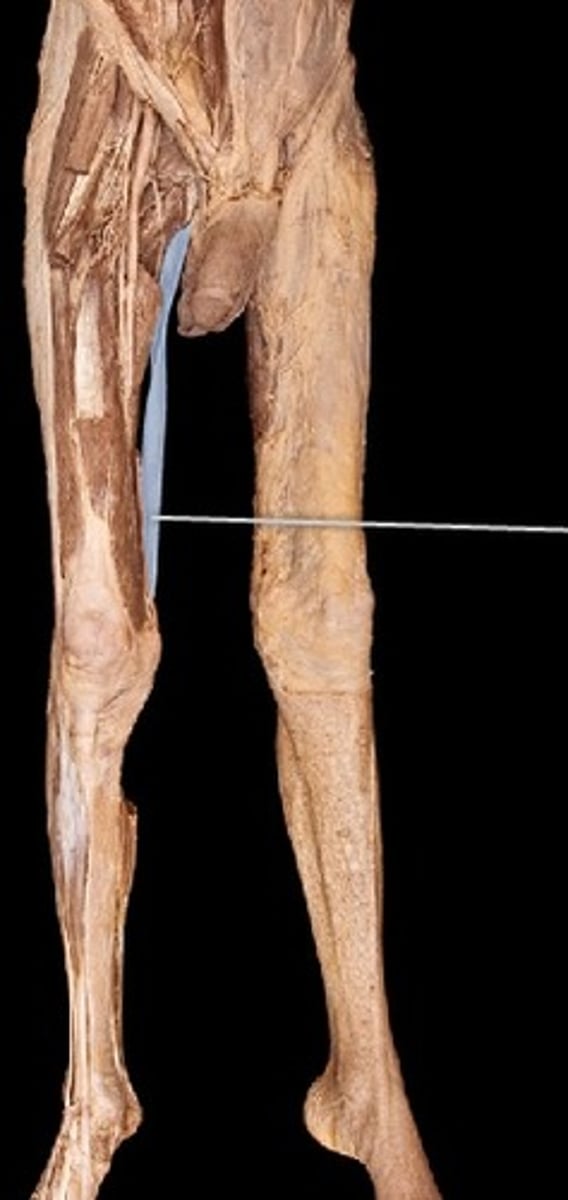 <p>What muscle is this?</p>