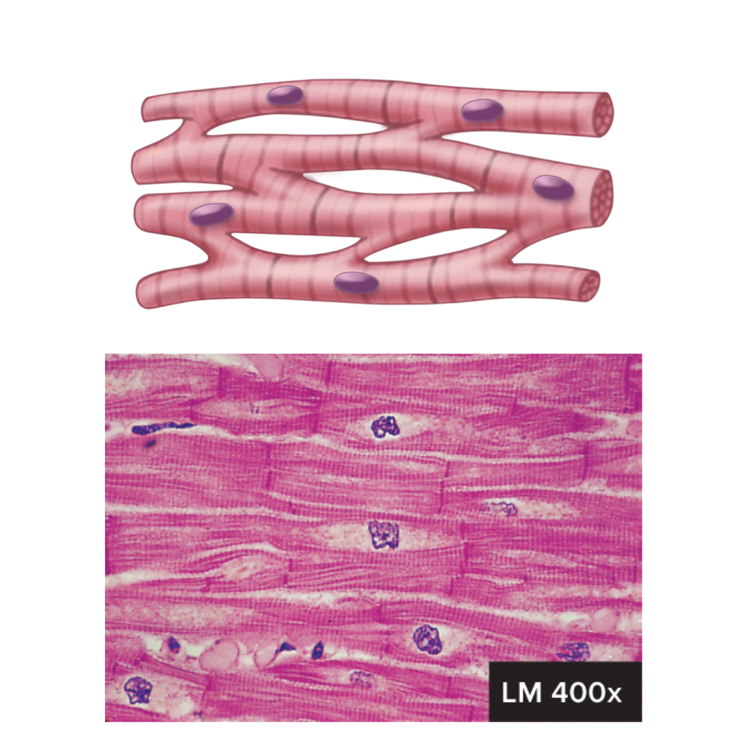 <p><strong>9.1: Functions of the Muscular System</strong></p><ul><li><p>located in the heart</p></li><li><p>cylindrical and branched</p></li><li><p>uninuclear, centrally located</p></li><li><p>intercalated disks join cells to one another</p></li><li><p>striations</p></li><li><p>involuntary control</p></li><li><p>capable of spontaneous contraction</p></li><li><p>pumping blood; contractions provide the major force for propelling blood through blood vessels</p></li></ul><p></p>