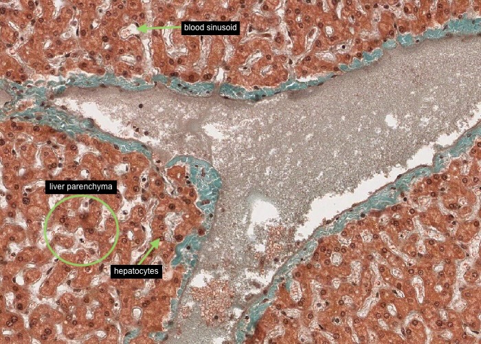 Liver parenchyma (Massons)