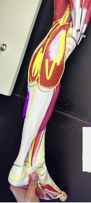 <p>What muscle is the purple line indicating?</p>