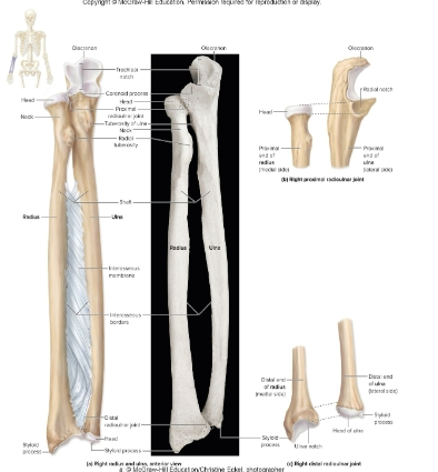 <p>Radius</p>
