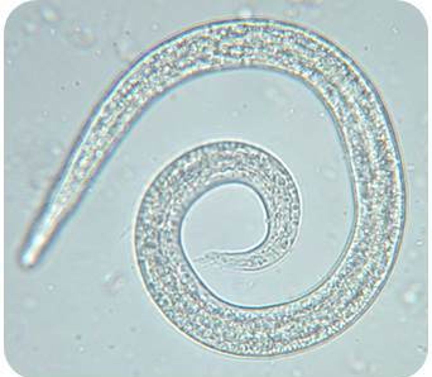 <p>What is this larva measuring ~300 um, was found on the Baermann exam of a coughing dog?</p>