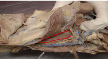 <p>elevates and retracts tongue</p>