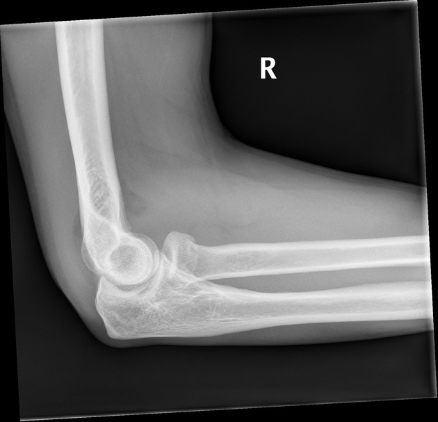 <p>Describe the abnormality demonstrated.</p>