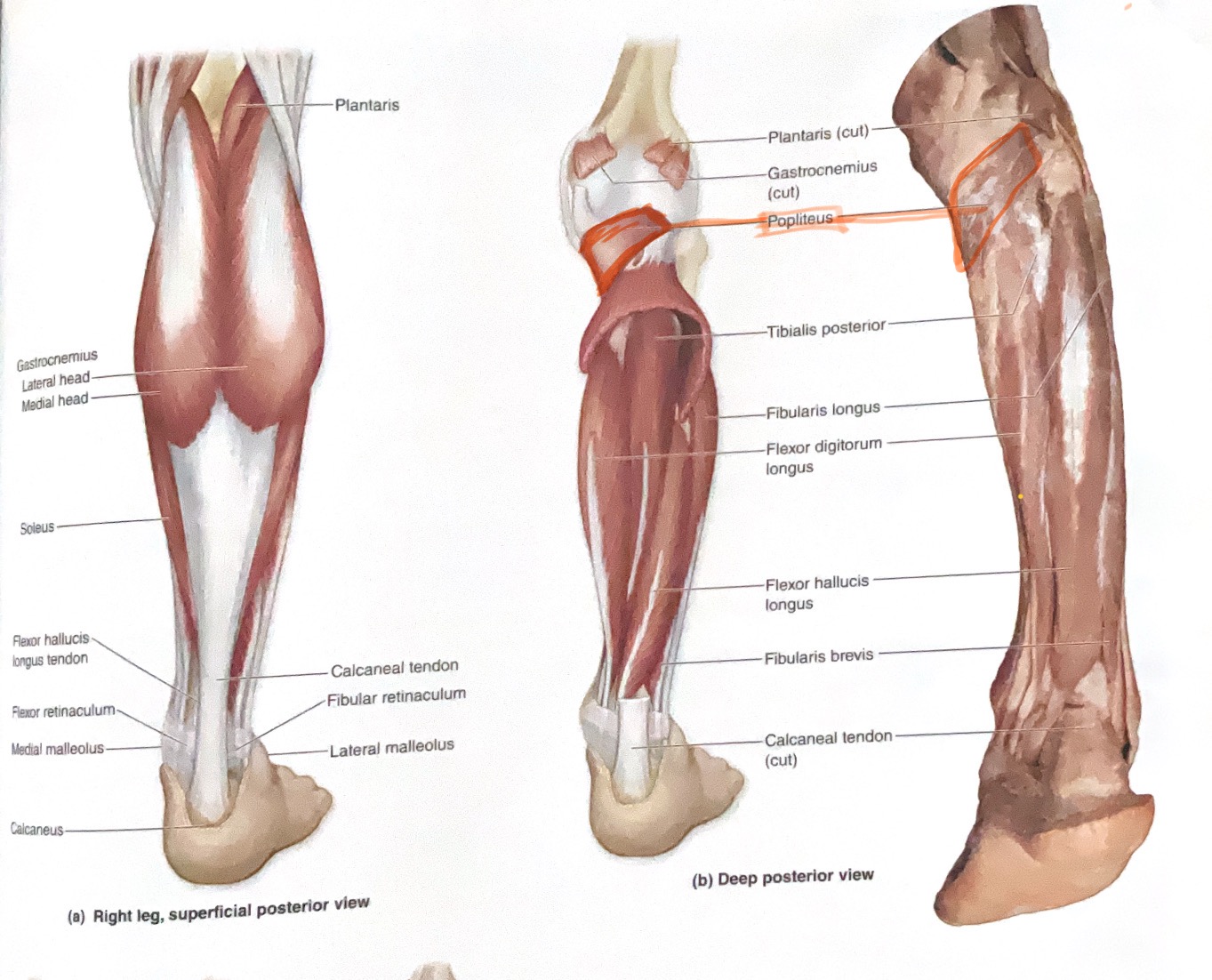 <p>Action: Medially rotate tibia(unlock knee)</p>