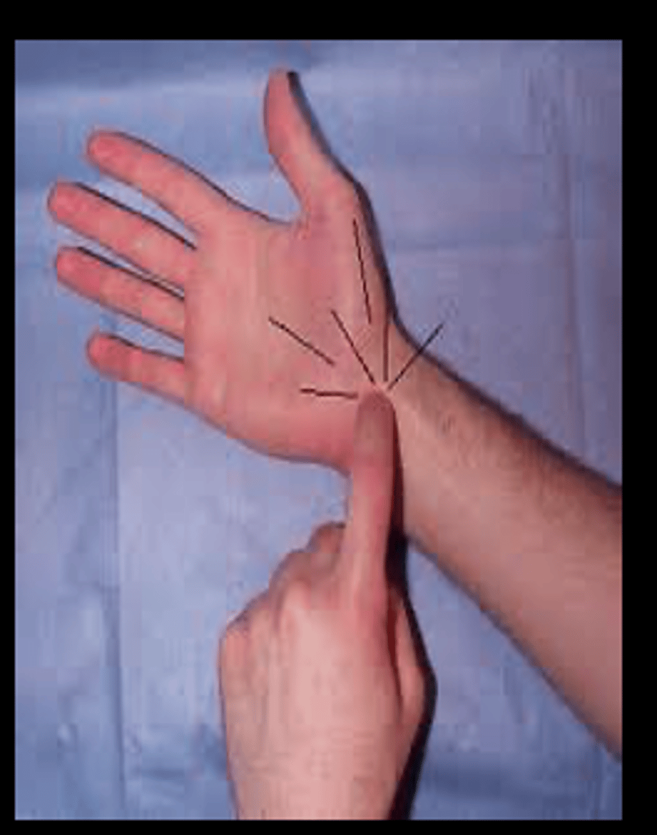 <p>direct percussion of the median nerve</p><p>-positive for carpal tunnel= tingling/burning</p><p>-no symps=normal</p>