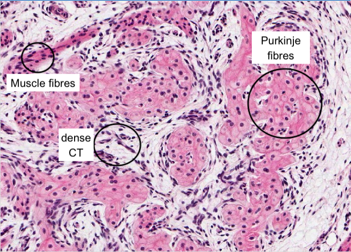 Atrioventricular bundle