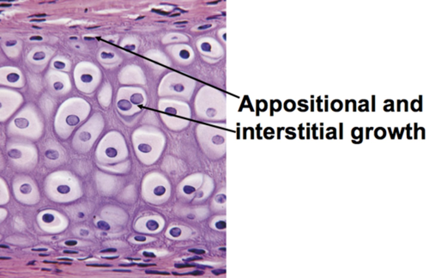 <p>-Interstitial: enlarges cartilages INSIDE<br>-Appositional: cartilage growth OUTSIDE</p>