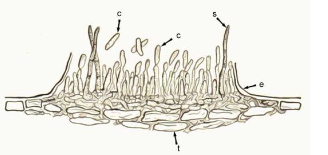 <p>Small asexual ascomycete fruiting body resembling a cushion or blister consisting of a mat of hyphae that is produced on a host by some fungi</p>