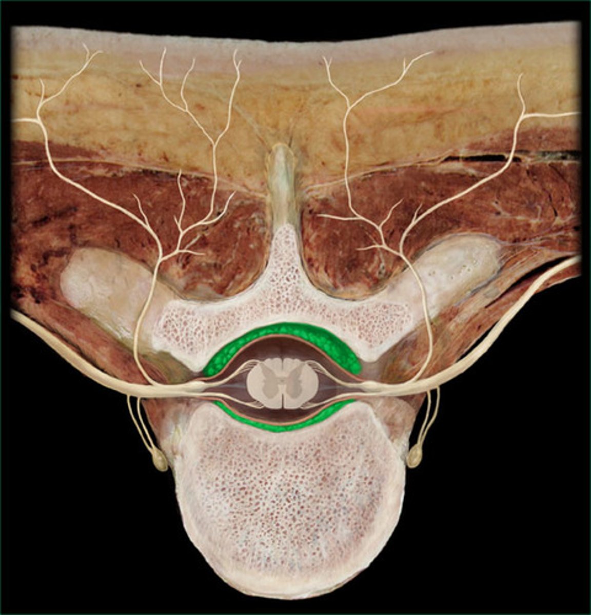 <p>Within the vertebral canal, lies between bone and dura mater</p>