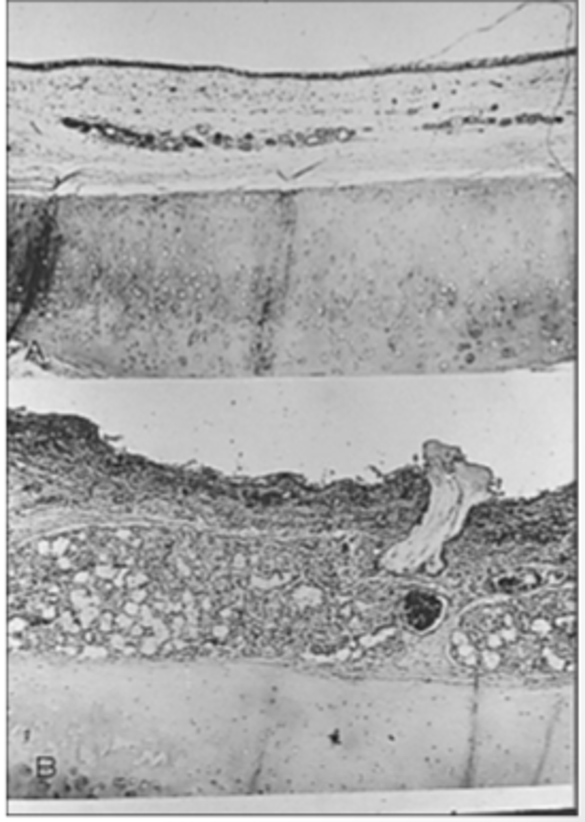 <p>Normal (top)</p><p>Enlarged (bottom)</p>
