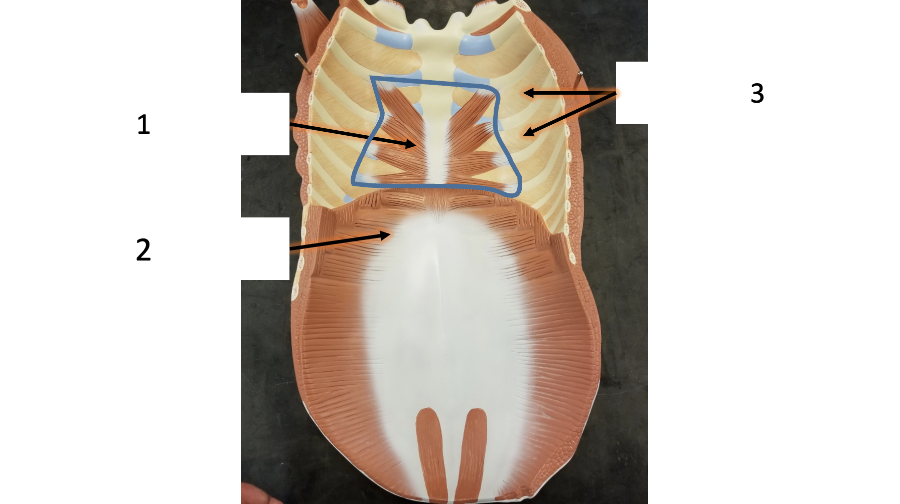 <p>name the muscle (3)</p>