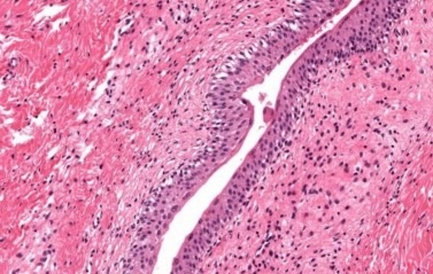 <p>bladder</p>