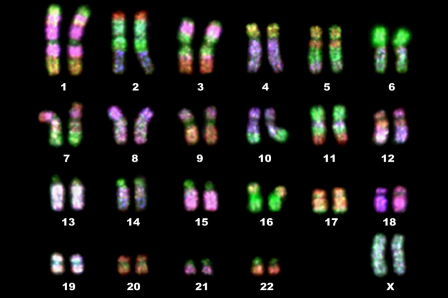<p>chromosomes that contain similar genes or DNA sequences but are not identical. Although they contain the same genes, the homologues carry different alleles of these genes. One of the pair comes from each parent. </p><p>The number of individual chromosomes each cell contains varies from one species to another. Human somatic cells have 46 chromosomes. These can be organized into 22 pairs of homologous chromosomes (similar-looking chromosomes) known as autosomes. Each somatic cell also has two sex chromosomes that may or may not be a homologous pair. The autosomes are numbered 1 through 22. By convention, sex chromosomes are counted as a pair even though X and Y are not homologous. Homologous chromosomes carry the same genes at the same location. Despite appearing similar, homologous pairs are not identical to each other, as they carry different forms, or alleles, of the same gene. This can be seen on a karyotype as each homologous strand must match up with its corresponding pair. Autosomes 1 to 22 and chromosomes X and Y are distinct from one another in several ways. For example, they vary in their overall length, the location of their centromere, and their staining properties. (Each chromosome has a distinct pattern of banding when stained.) These three characteristics are the same in homologous chromosome however, homologous chromosomes are not identical to one another, because they carry different forms, or alleles, of the same genes. They have several other characteristics in common, such as their length, centromere location, and banding pattern. The particular set of chromosomes that an individual possesses is called their individual karyotye. They complete the karyotype by organizing the images into a series of homologous pair. Homologous chromosomes are not identical. Although they contain the same genes, the homologues carry different alleles of these genes.</p>