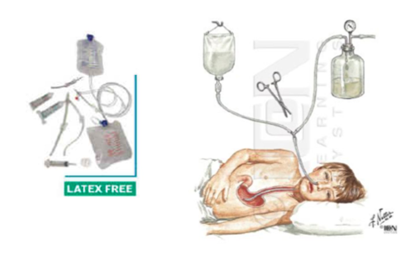 <p>irrigate and cleanse the wound</p>