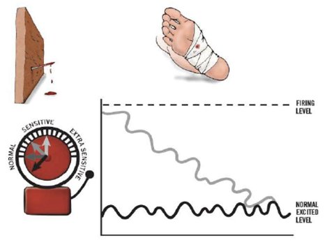 <ul><li><p>once you take the nail out, the alarm should go back down </p></li><li><p>thje alarm goes down slowly </p></li><li><p>you will likely feel discomfort or pain in the foot for a day or two </p></li><li><p>this is normal </p></li></ul><p></p>