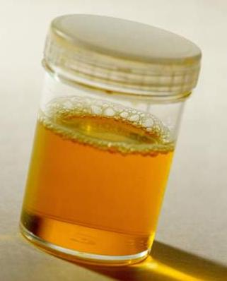 <p>Amber (with yellow foam).</p>