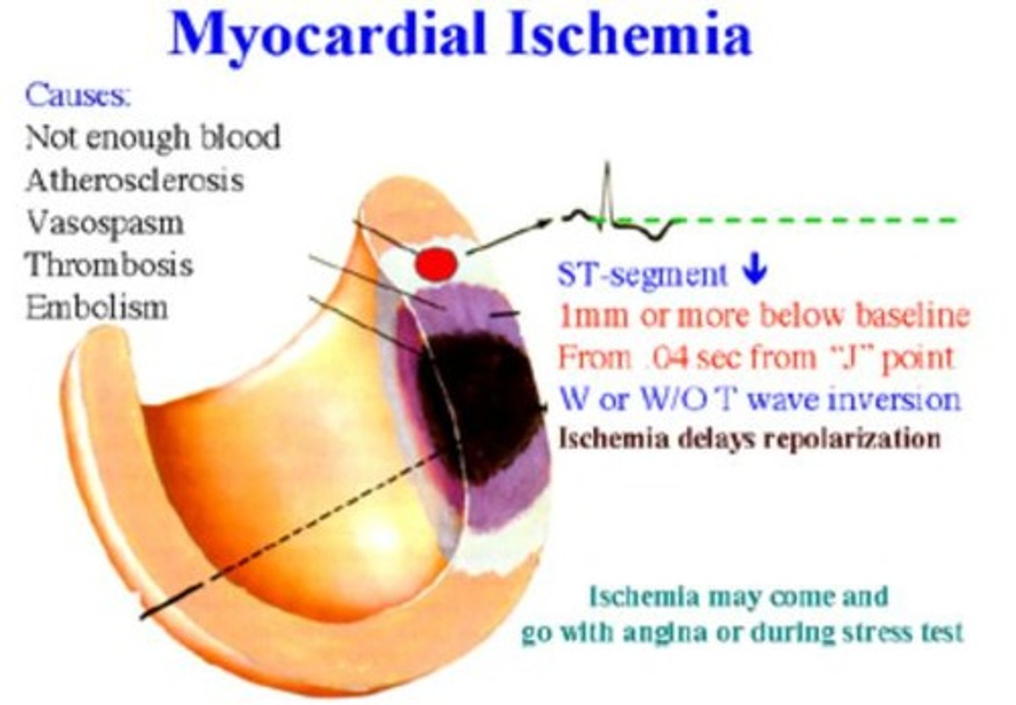 <p>Improved cardiovascular fitness, VO2 peak, endothelial function, left ventricular function, and mitochondrial density/function.</p>