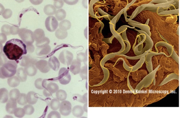 <p>Genus: Trypanosoma</p>