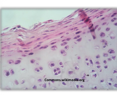 <p>Hyaline cartilage</p><p>-most abundant and common</p><p>-chondrocytes form isotonic groups</p><p>-mostly type 2 collagen</p><p>-nasal septum</p><p></p>
