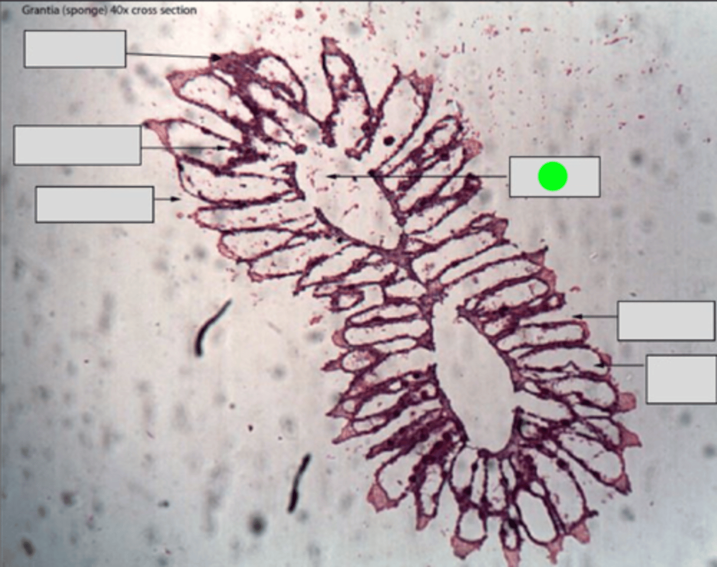 <p>Central cavity within a sponge's body. It is lined with choanocytes and serves as a chamber for water circulation.</p>