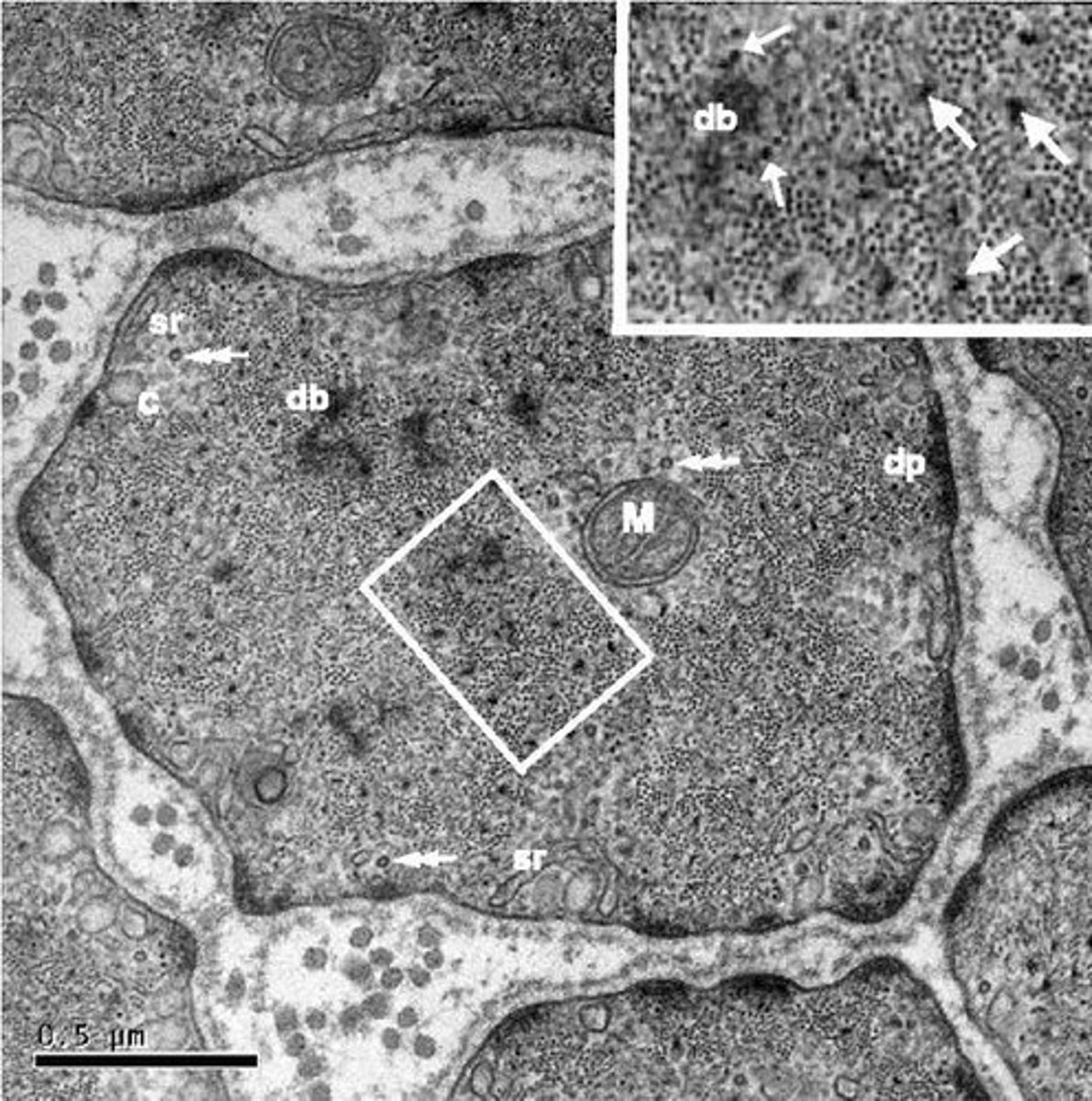 <p>Dense bodies anchor thin filaments in smooth muscle cells and the thick filament stays in between the 2 thin filaments held by dense body</p>