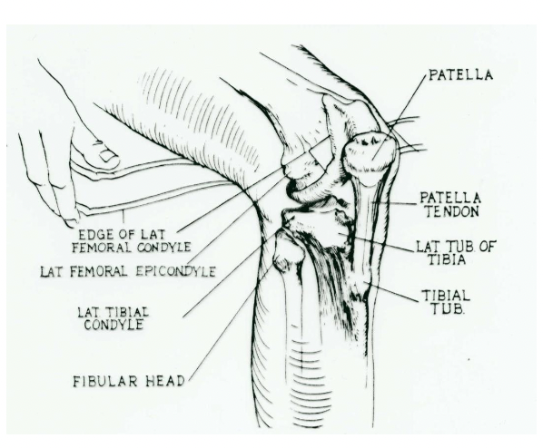 <ul><li><p>Femoral condyles &amp; epicondyles: medial &amp; lateral</p></li><li><p>Patella: Femoral sulcus, patellar tendon</p></li><li><p>Tibial plateau w condyles</p></li><li><p>Tibial tubercle, fibula</p></li><li><p>Joints: </p><ul><li><p>Tibio-femoral </p></li><li><p>patello-femoral </p></li><li><p>proximal tibio-fibular</p></li></ul></li><li><p>Ligaments: </p><ul><li><p>Extra-articular: MCL/LCL</p></li><li><p>Intra-articular: ACL/PCL</p></li></ul></li><li><p>Menisci: medial &amp; lateral</p></li></ul><p></p>